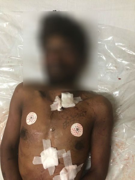 ANE MURDER 1