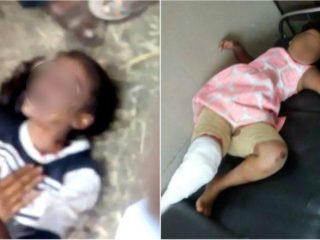 CKD CHILD DEATH small