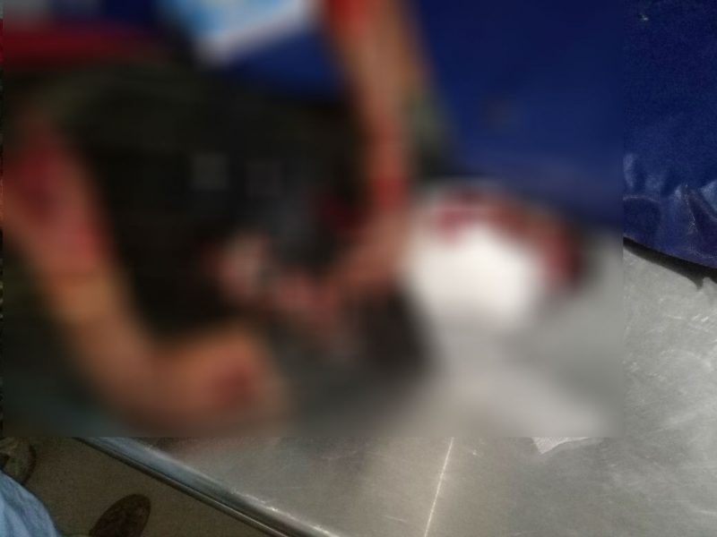 HVR BUS ACCIDENT 2