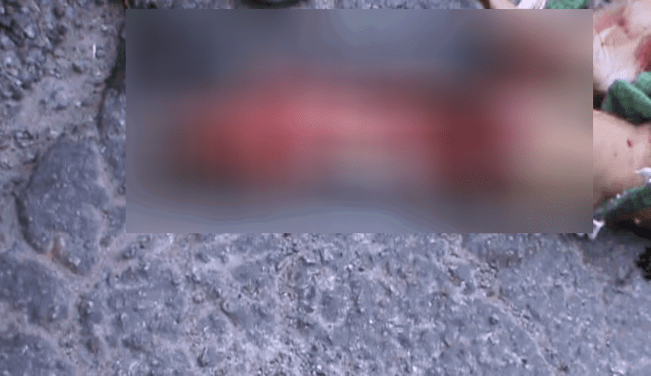 NML ACCIDENT LEG 4