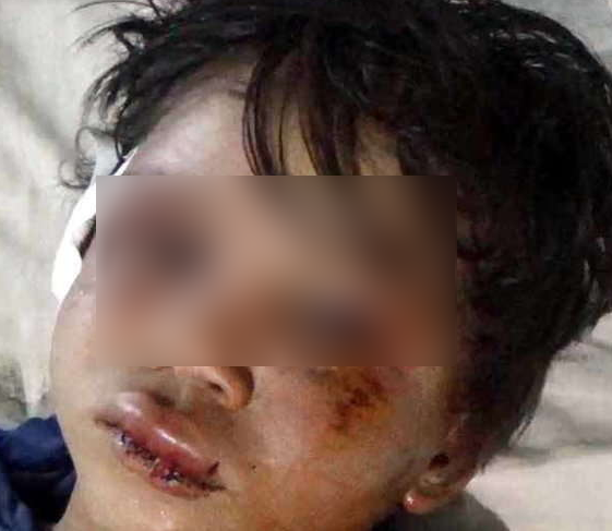 boy father assault 1