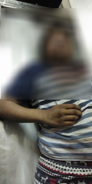 ANE DOWRY DEATH