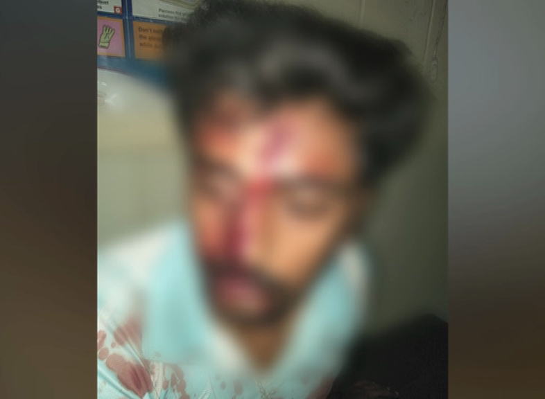 BNG ACCIDENT 1