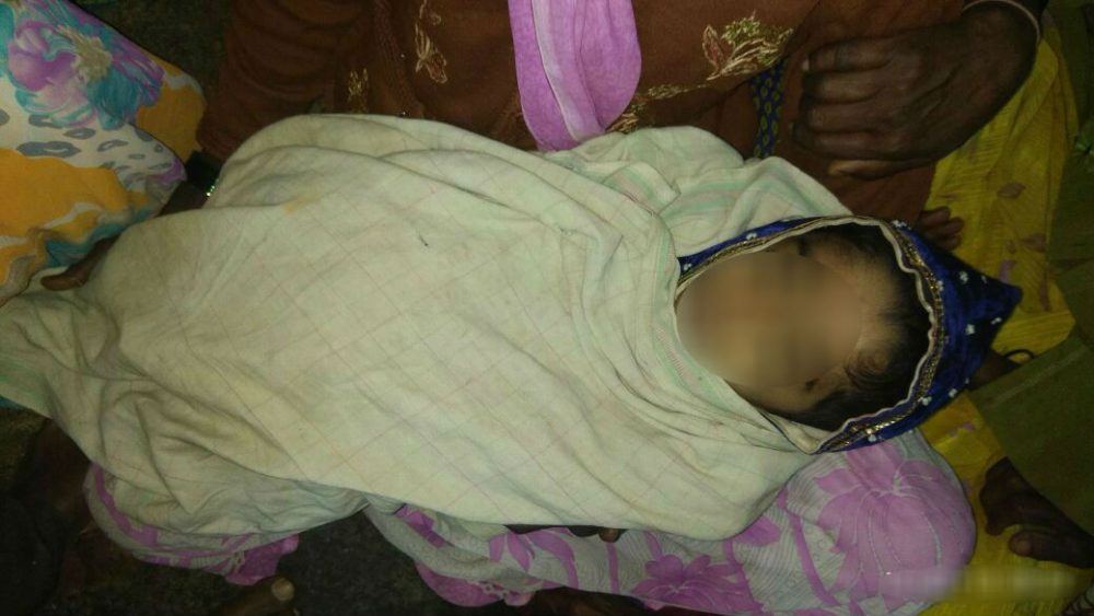 CKD CHILD DEATH 2 1