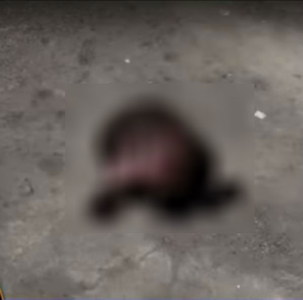 infant head 5