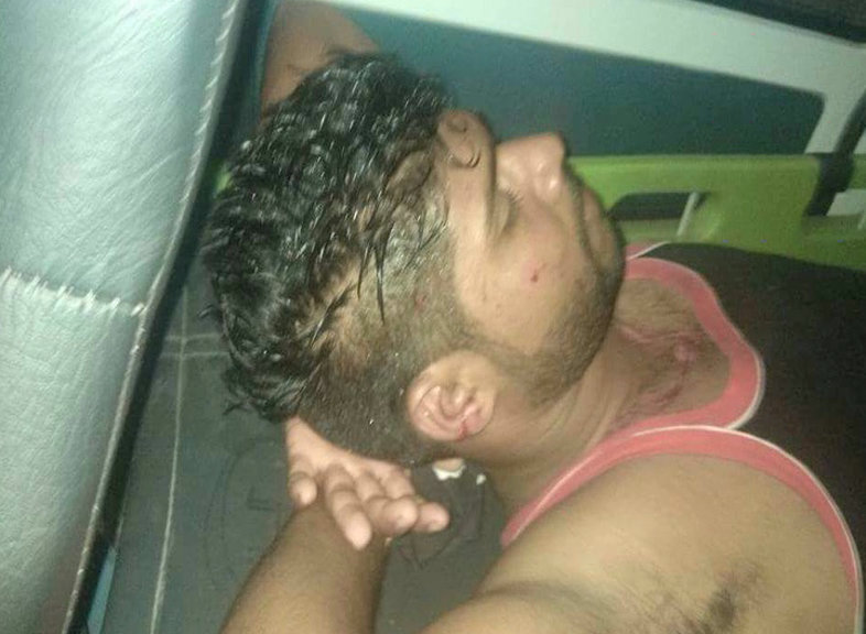 mng bus attack 3