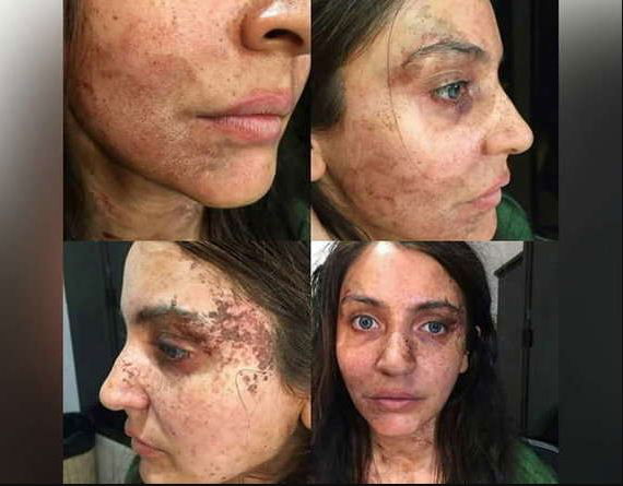 ANUSKA PARI 1