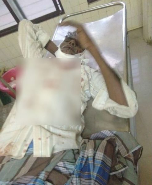 MND SERIES ACCIDENT 7 1