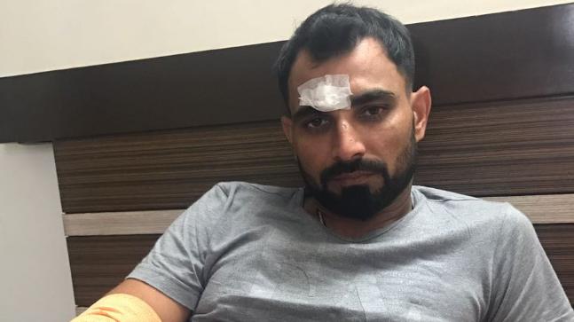 Shami injured