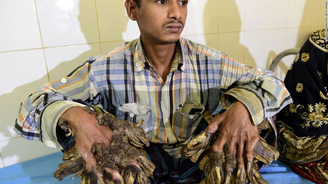 tree man a