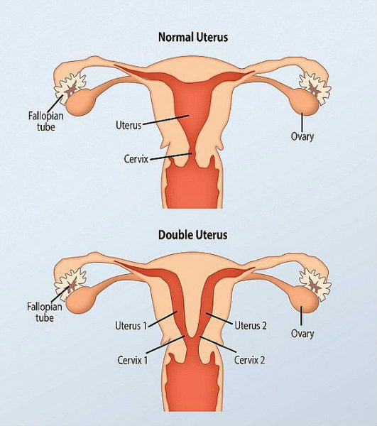 twins baby 2