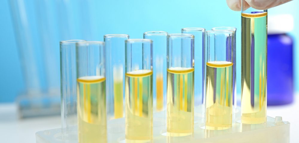 urine