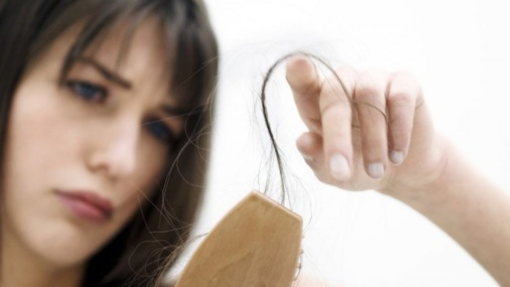 hair loss in femail