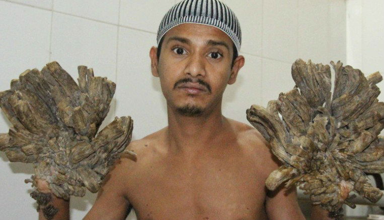 tree man 1
