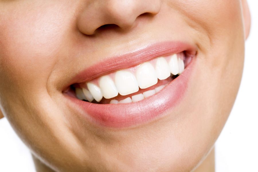white teeth