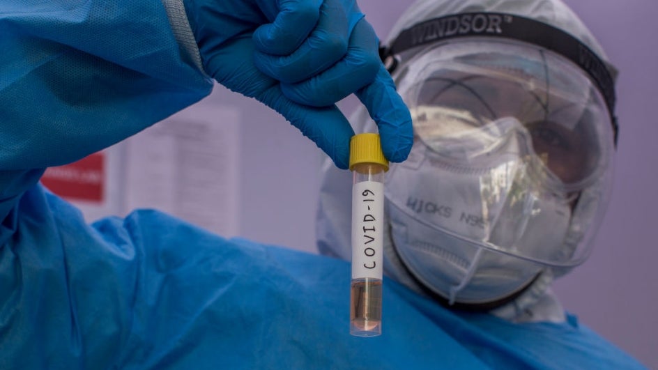 plasma therapy 1 1