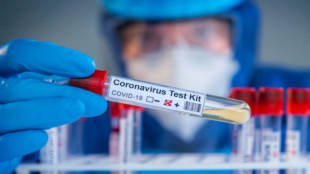 xCOVID lab research testing