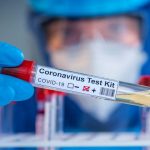 xCOVID lab research testing