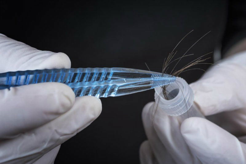 Hair Follicle Drug Test 2