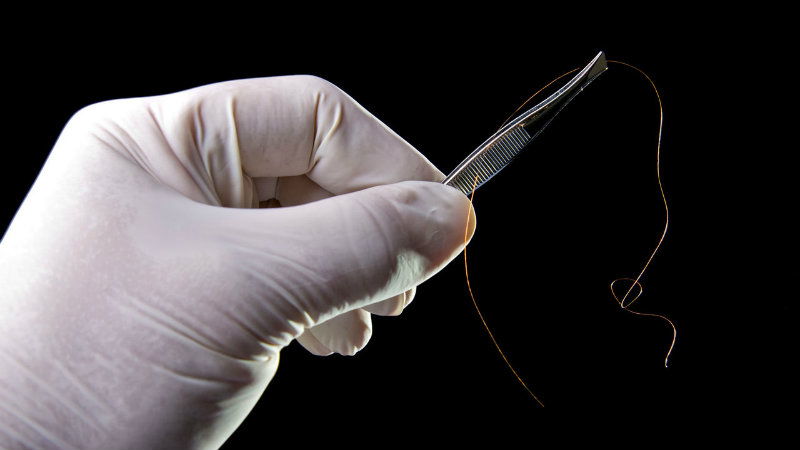 Hair Follicle Drug Test 3
