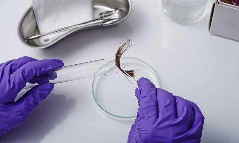 Hair Follicle Drug Test