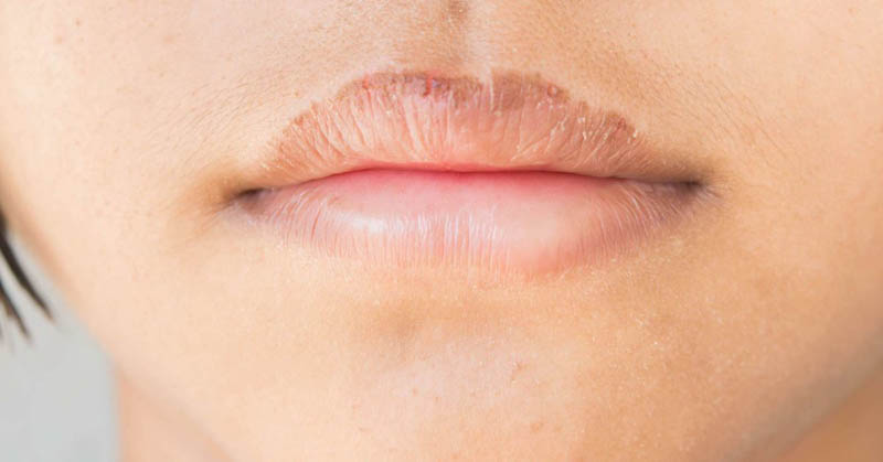 Lip Health Tips 7