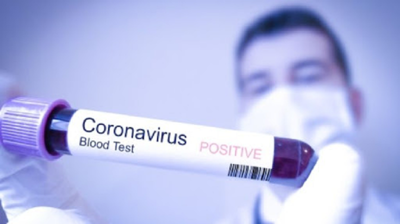 corona virus 4 medium
