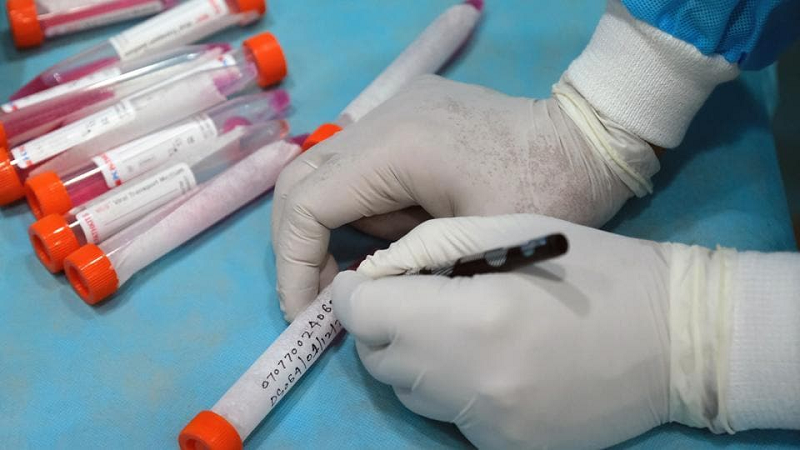corona virus medium