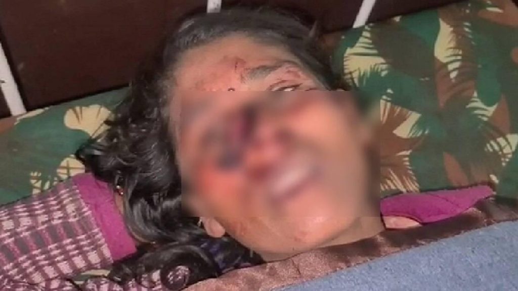 bhopal incident 3