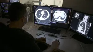 cancer technology
