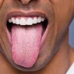 tongue
