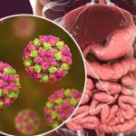 Norovirus