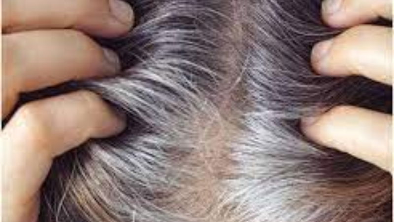 white hair