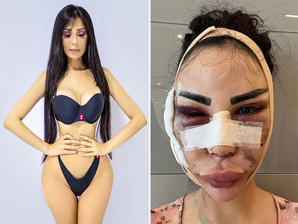 surgery