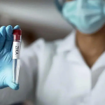 zika virus