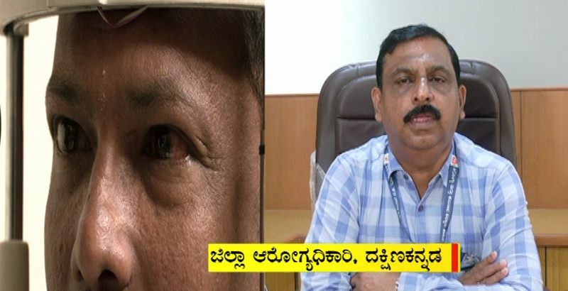 MANGALURU MADRAS EYE 1