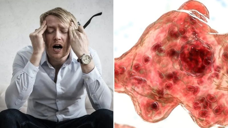 Brain eating amoeba 5