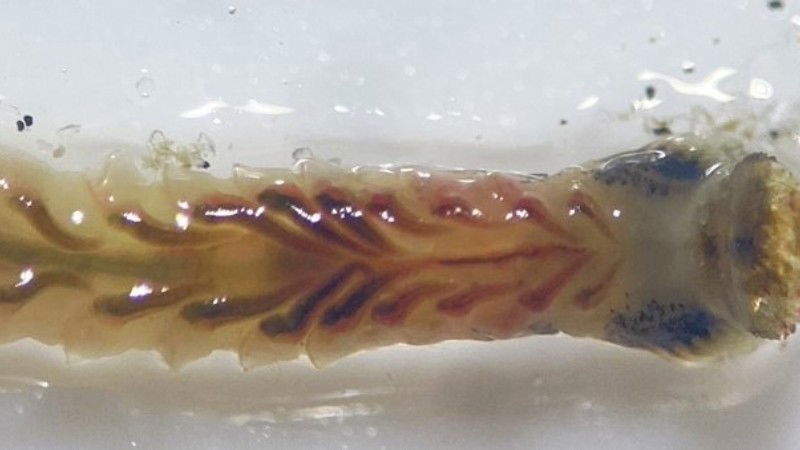ಬೆಲ್ಲಾರಿಯಾದ ಲಾರ್ವ (ಮರಿ ಹುಳ) - ಸೂಕ್ಷ್ಮ ದರ್ಶಕ ನೋಟ