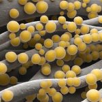 New study shows alarming rates of antibiotic resistant bacteria on Australias doorstep