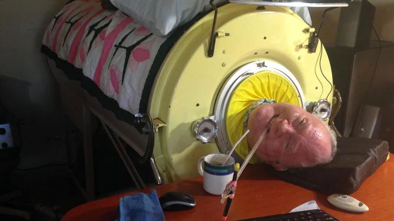 iron lungs