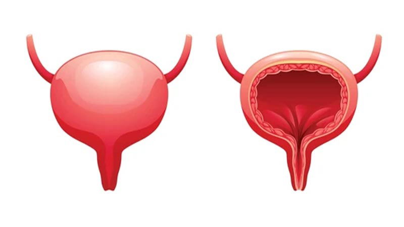 urinary symptoms