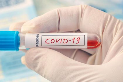 Covid Test