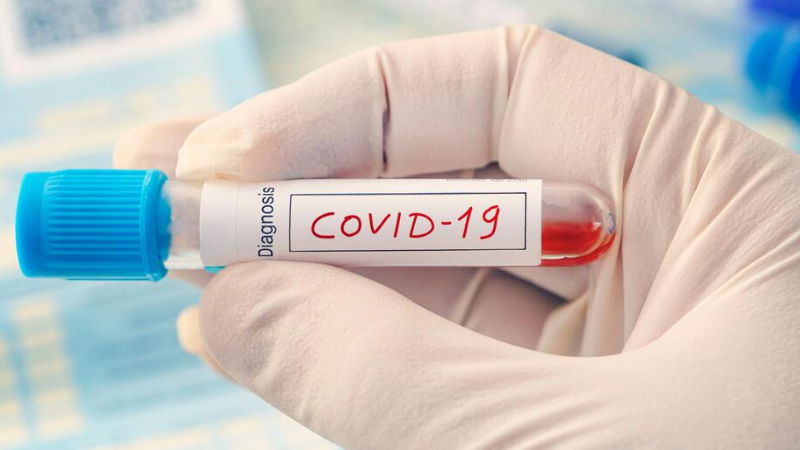 Covid Test