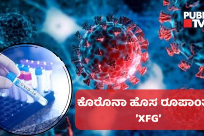 XFG